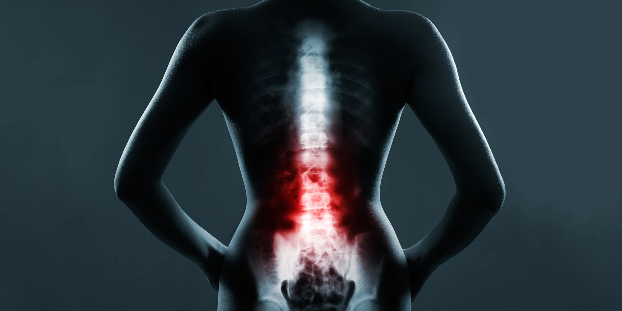 Chiropractic-Clearwater-FL-Stem-Cell-Therapy-Slider-Mobile.webp